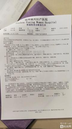 今天去照了四维,医生说没啥问题,划线的地