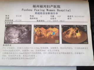 B超图谁会看的?为什么没有回应