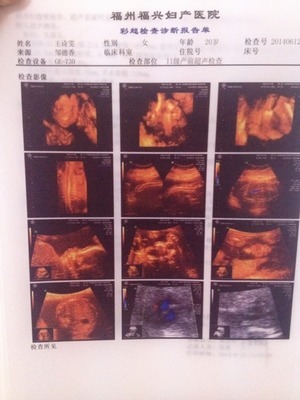 福州妈妈圈热议 看看是男是女，福兴妇产医院的科学性别鉴定指南