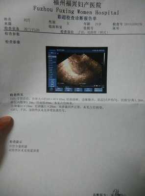 产后70多天恶露不净，福州福兴妇产医院为您解析原因与应对